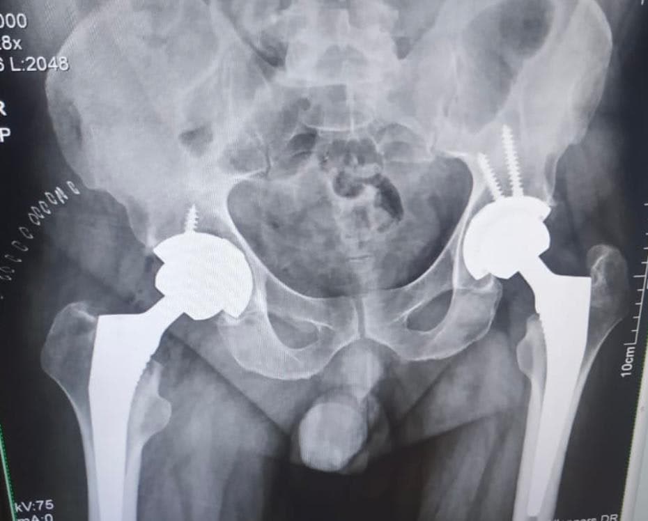 Dr. Vikramjit Singh Baath | ORTHOPRO screenshot 1